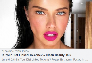Is Your Diet Linked To Acne? 2 81ec28ae bdb3 4d95 be56 a5eb6bae19cb