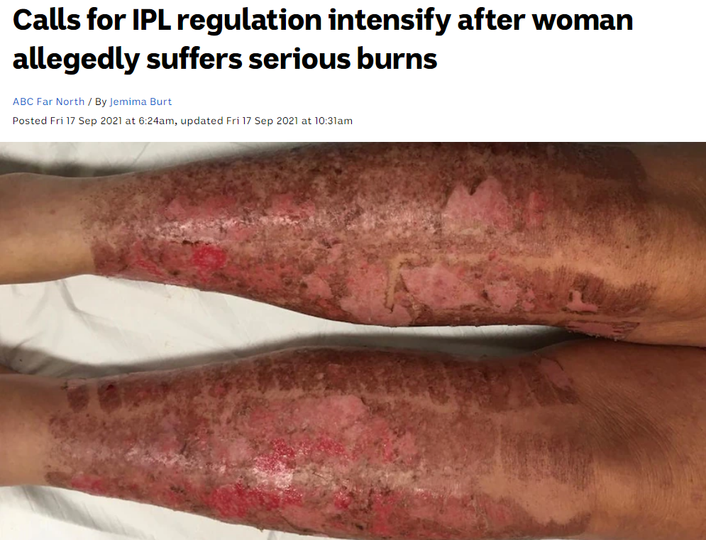 2021.09.17 Calls for IPL Regulation Intensify after Woman Allegedly Suffers Serious Burns ABC News